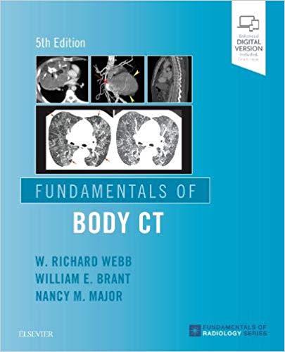اصول CT بدن (مبانی رادیولوژی) - رادیولوژی
